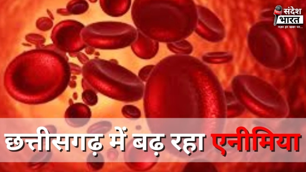 छत्तीसगढ़ में एनीमिया का बढ़ता खतरा: एक गंभीर चुनौती ?
